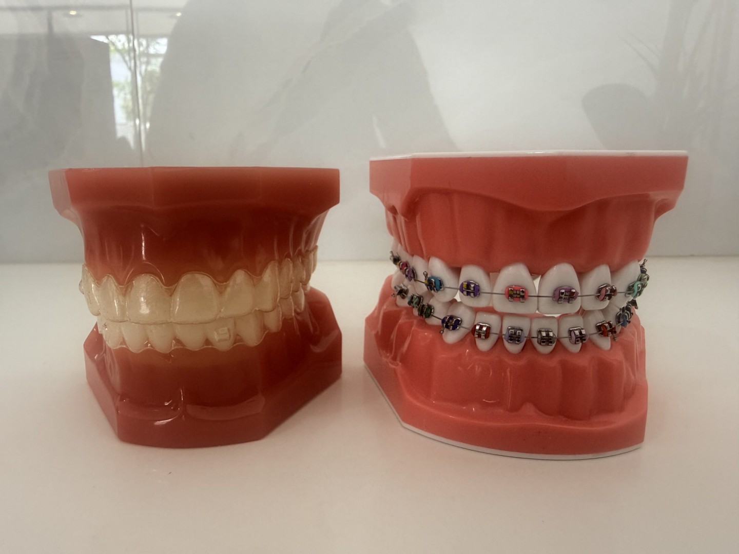 Invisalign vs Braces for Kids